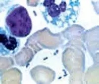 杭州美卓生物科技有限公司 | 鼠疫可防可控可治，這些知識(shí)你應(yīng)該知道