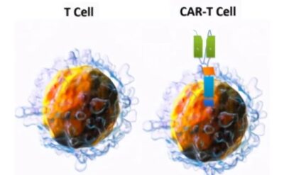 CAR- T 細(xì)胞的制備過程